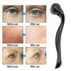 Derma Roller